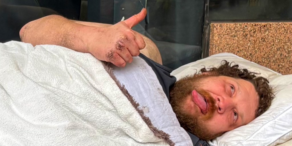 A person lying on a bed covered with a white blanket, giving a thumbs up gesture. The individual has a beard and is looking towards the camera.